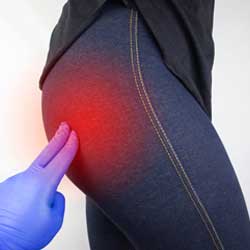 Sciatica Treatment in Hyderabad