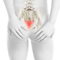 Tailbone Pain treatment in hyderabad